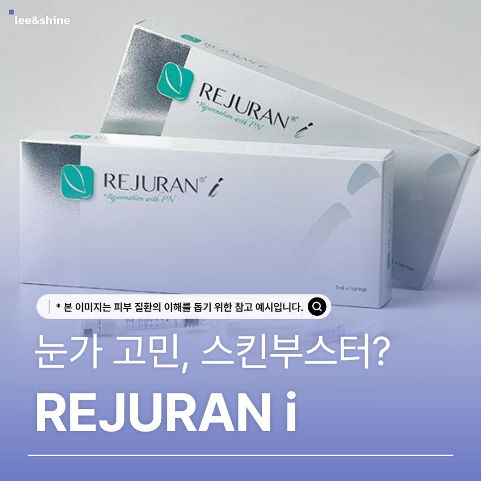 눈가 고민과 리쥬란 아이를 소개하는 블로그 원문 대표 이미지